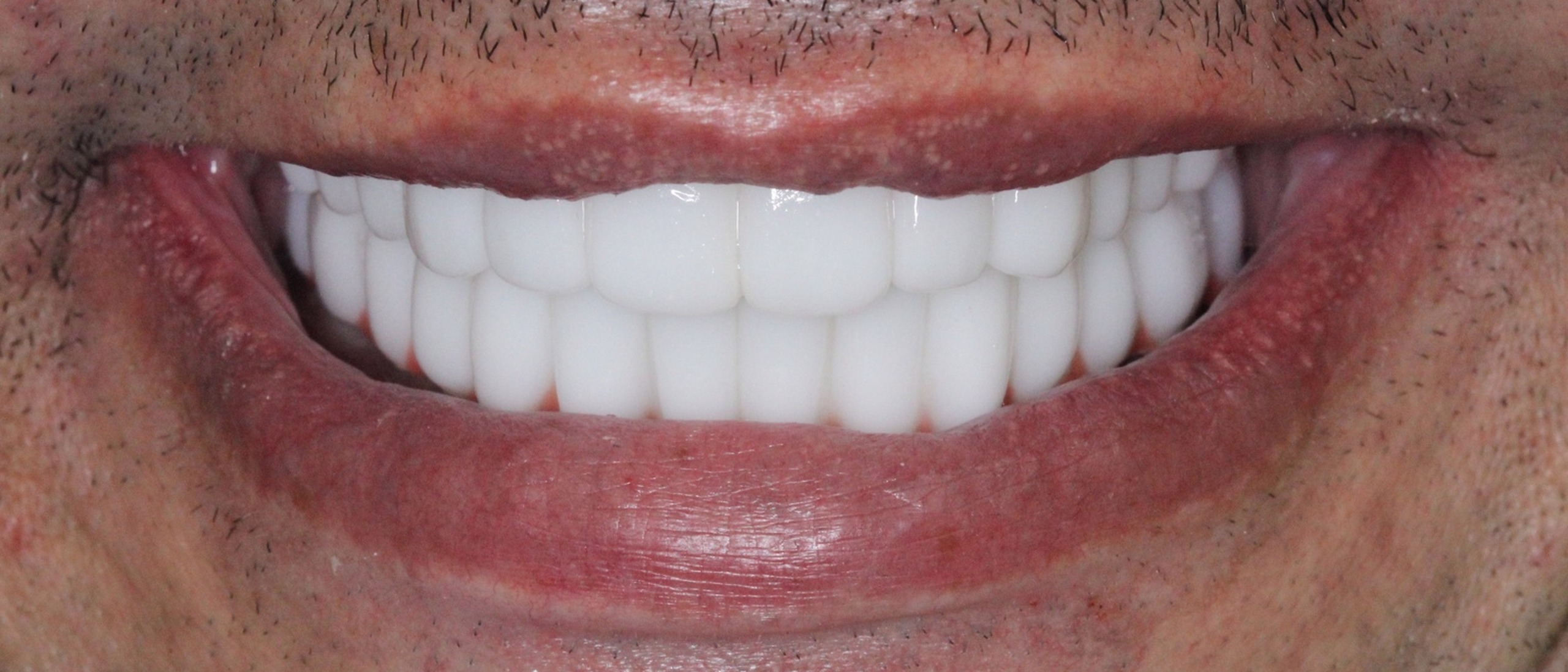 Teeth Images